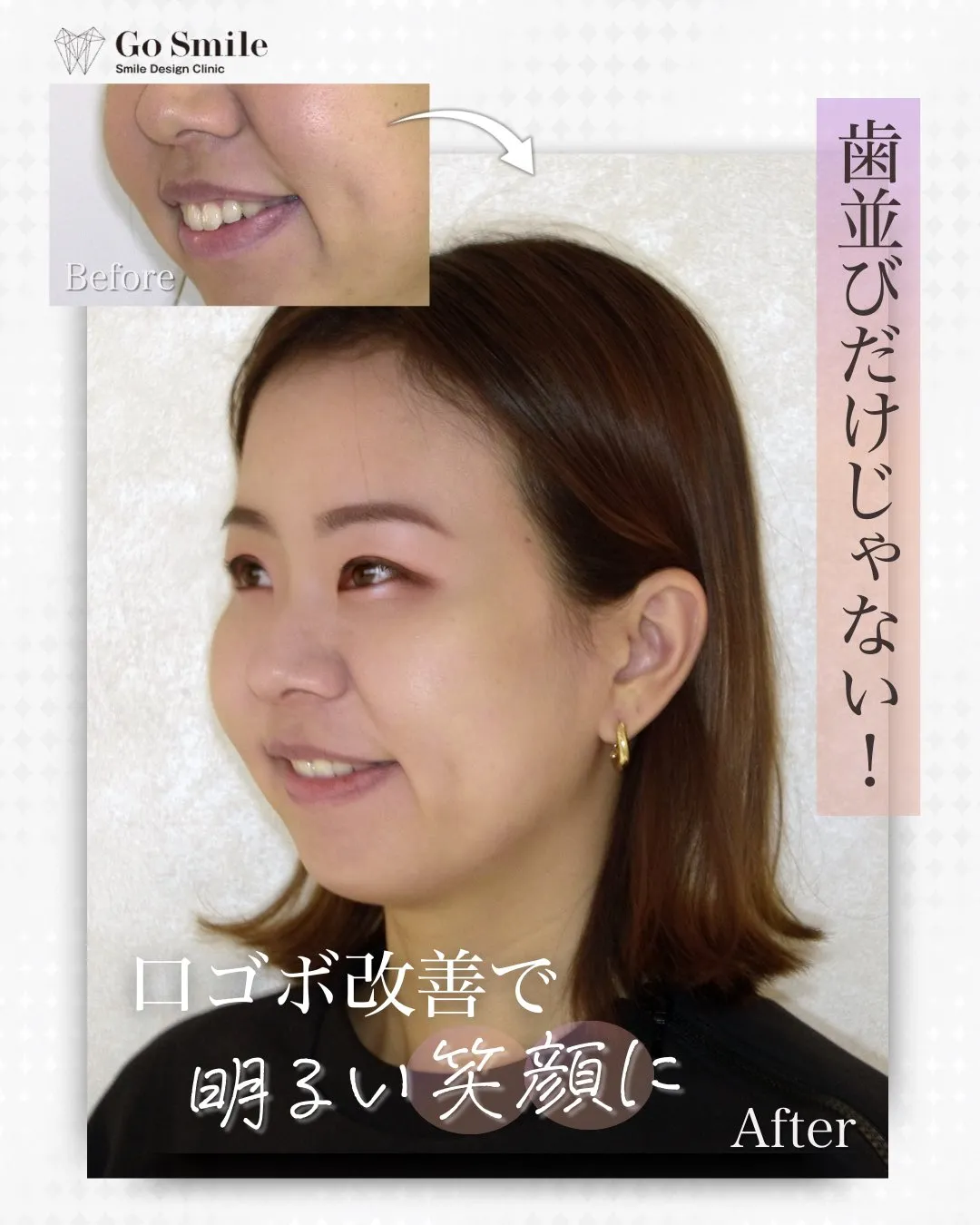 歯並びだけじゃない！