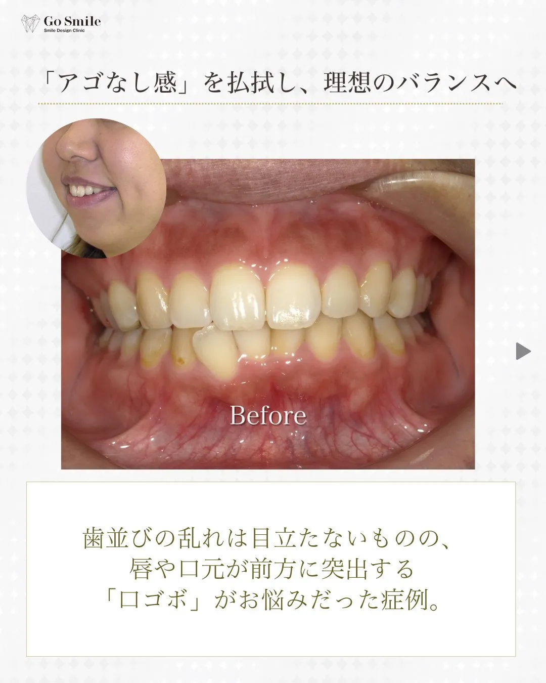 歯並びだけじゃない！