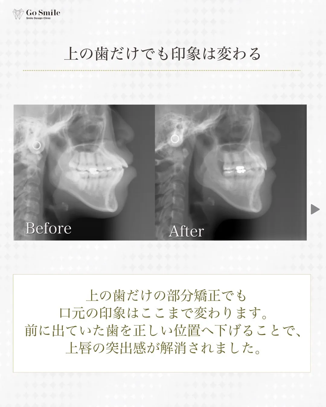 自信あふれる笑顔