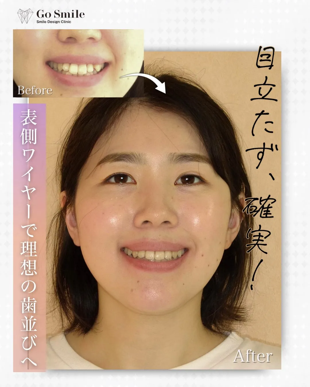 目立たず、確実！