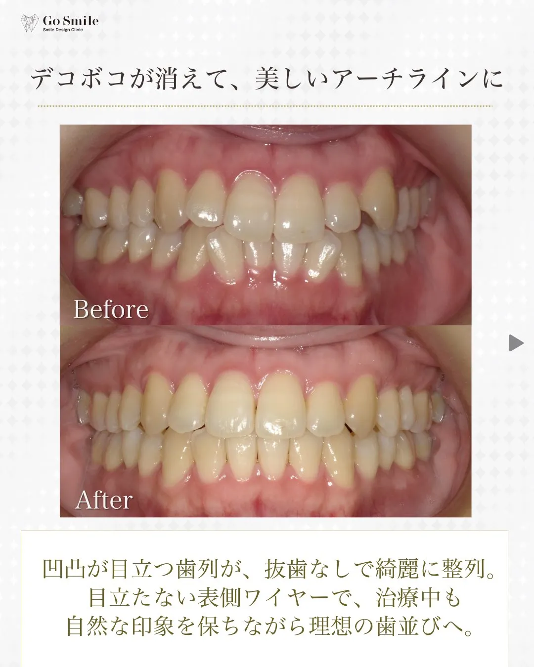 目立たず、確実！