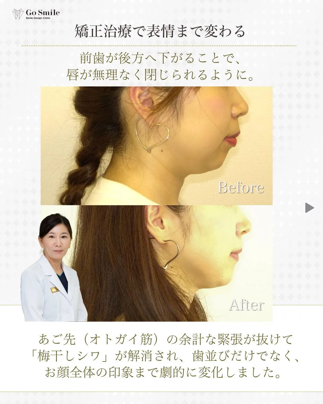 Smileに自信を！