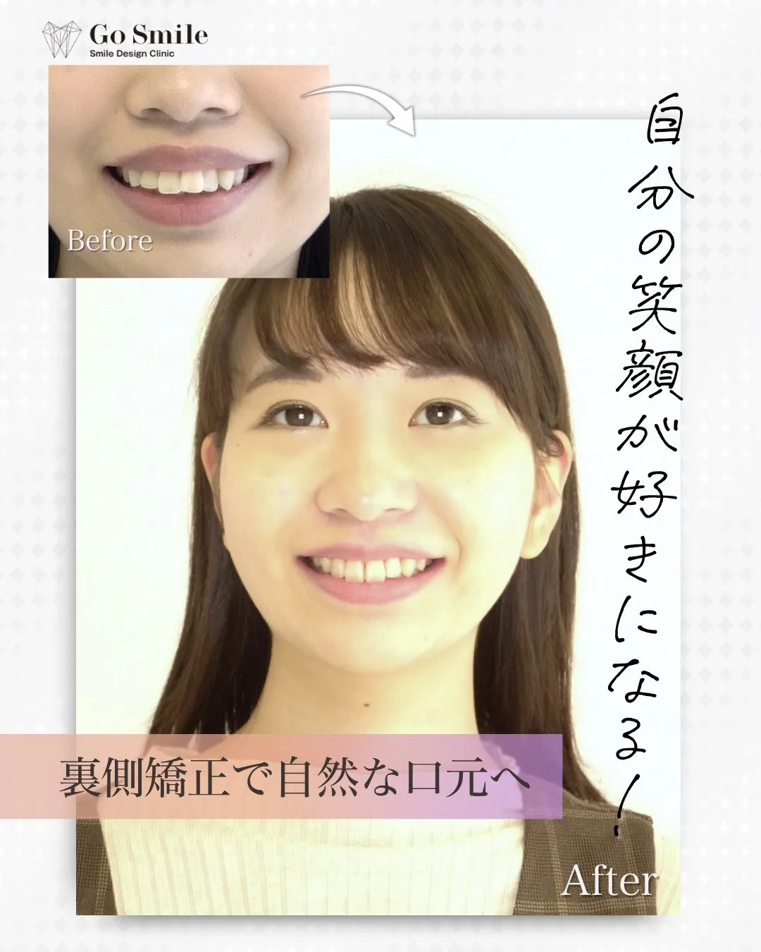 自分の笑顔が好きになる！