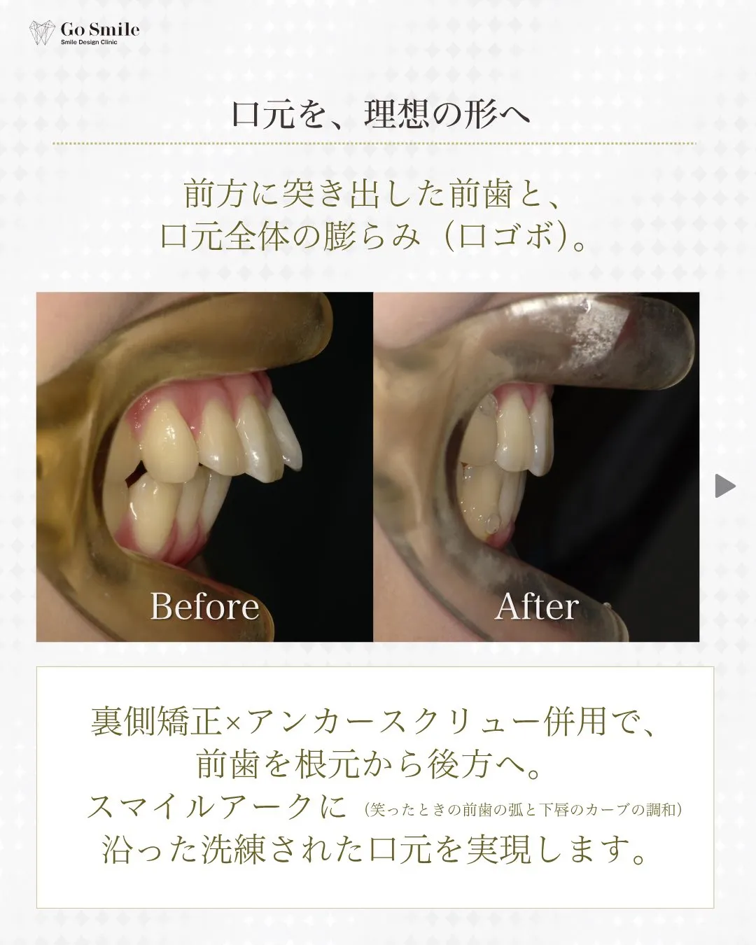 自分の笑顔が好きになる！