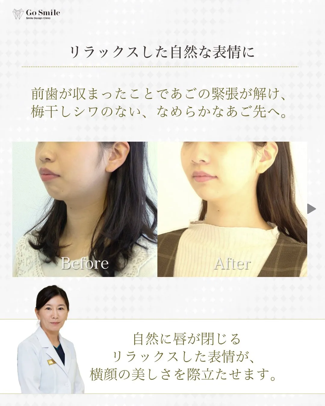 自分の笑顔が好きになる！