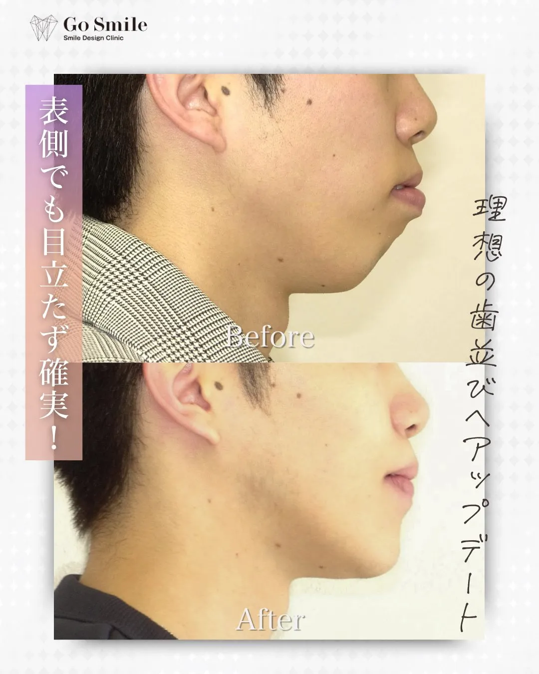 表側でも目立たず確実！