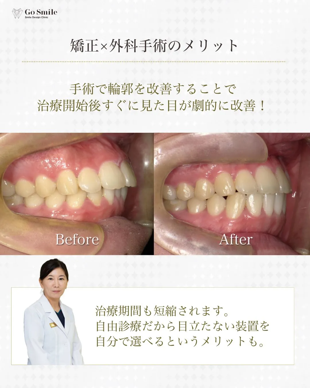 表側でも目立たず確実！