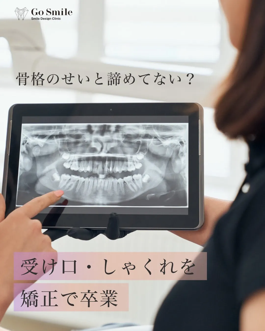 骨格のせいと諦めてない？