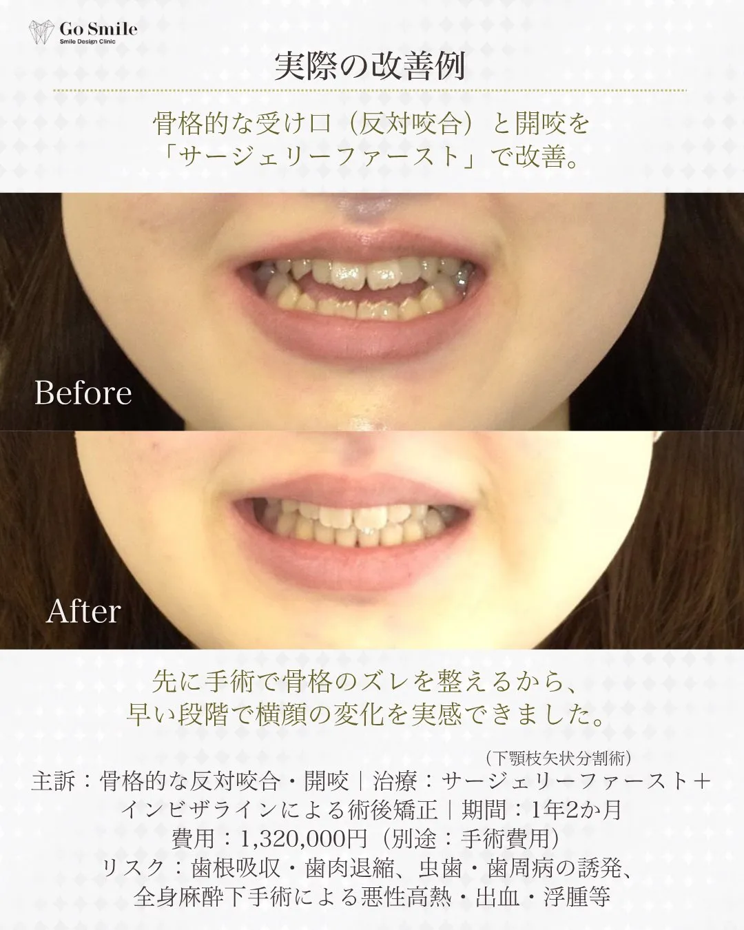 骨格のせいと諦めてない？