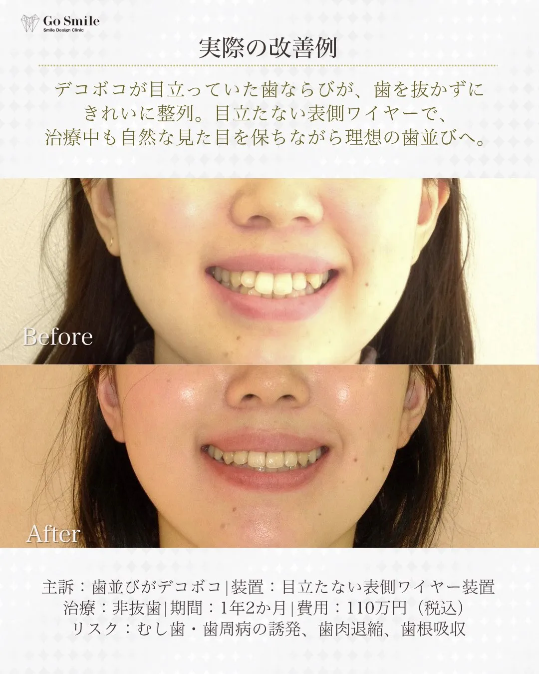 歯並びだけじゃない