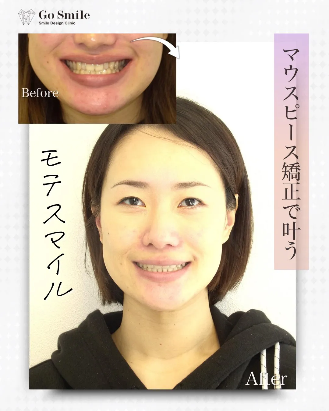 横顔もスッキリ！