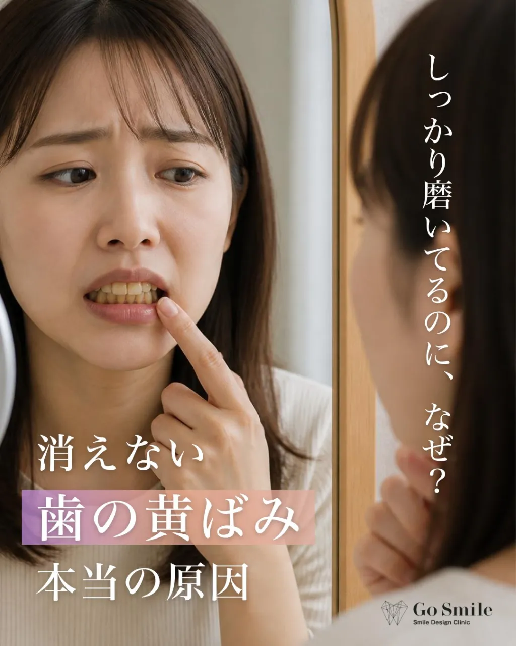 しっかり磨いてるのに、なぜ？