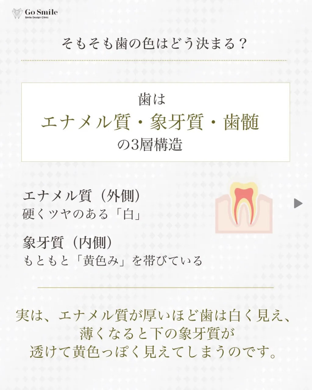 しっかり磨いてるのに、なぜ？