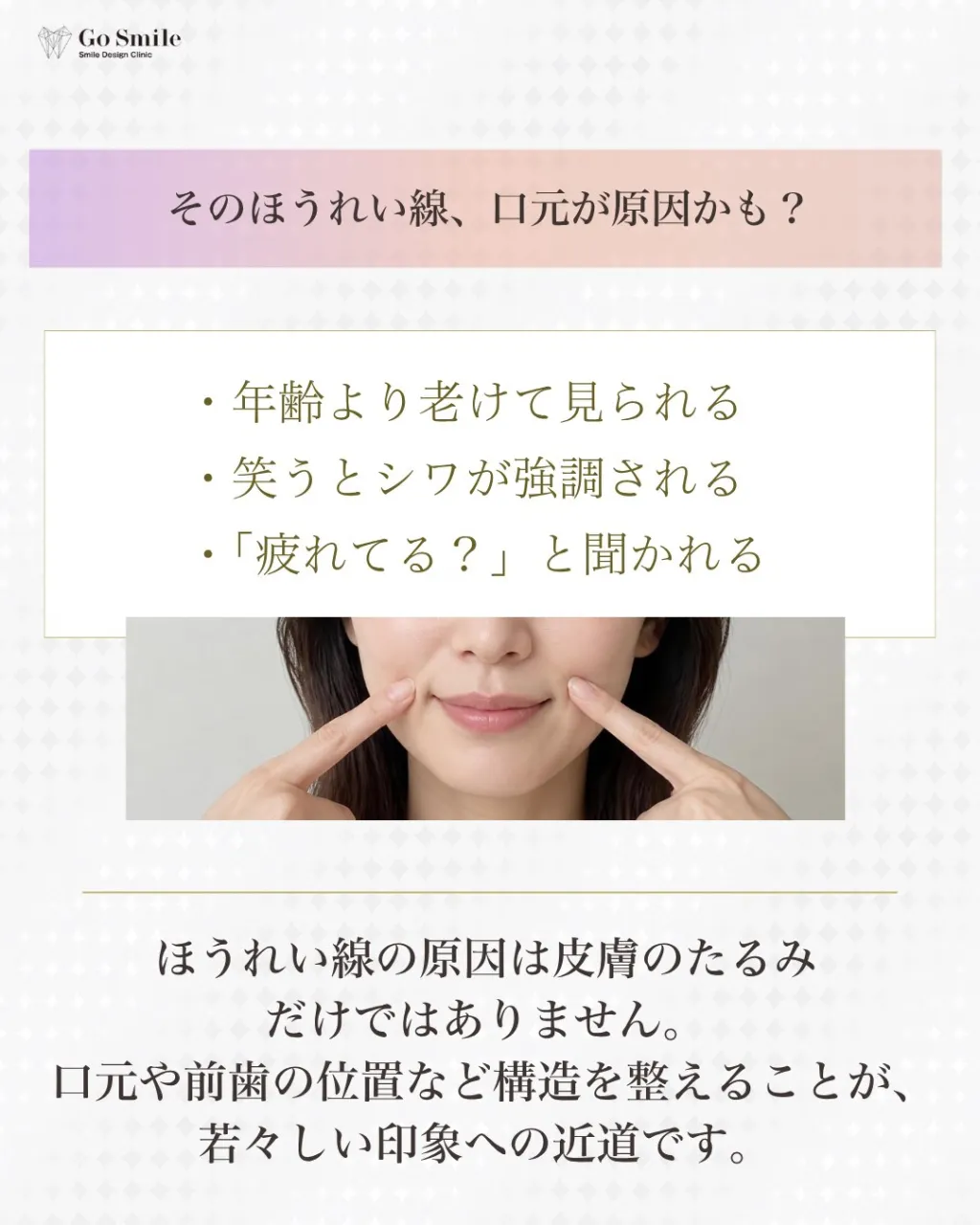 たるみのせいだけじゃない。
