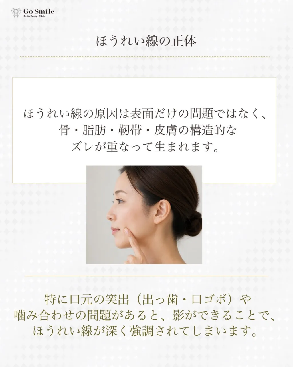 たるみのせいだけじゃない。
