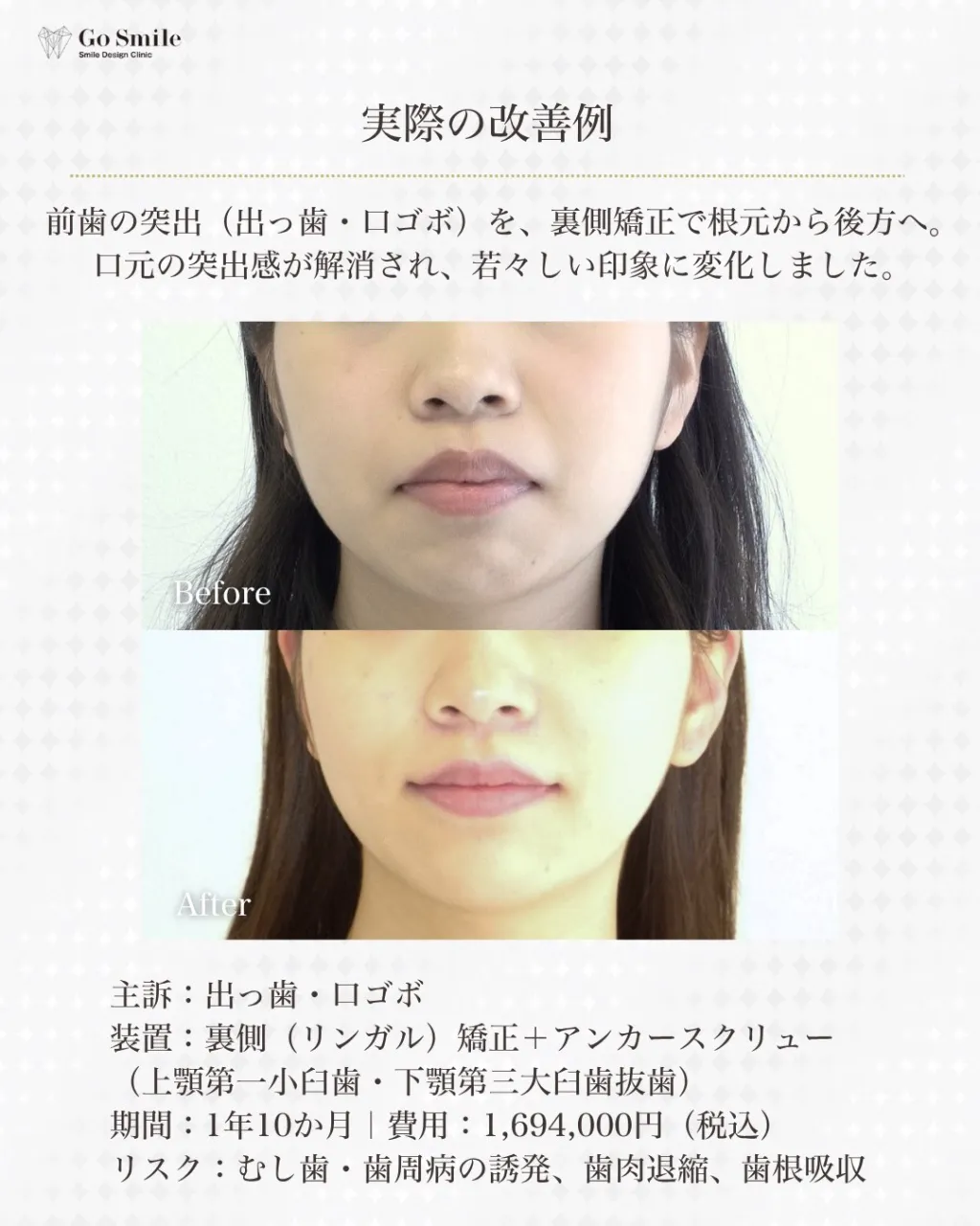 たるみのせいだけじゃない。
