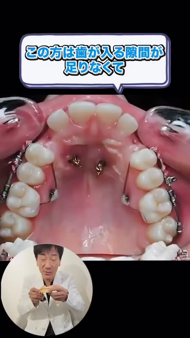 こんなことできるって知ってた？#矯正歯科gosmile横浜 ...