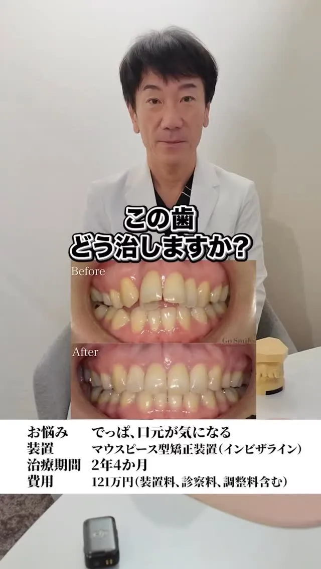 当院はこんな感じ#矯正歯科gosmile横浜 #矯正 #歯科...