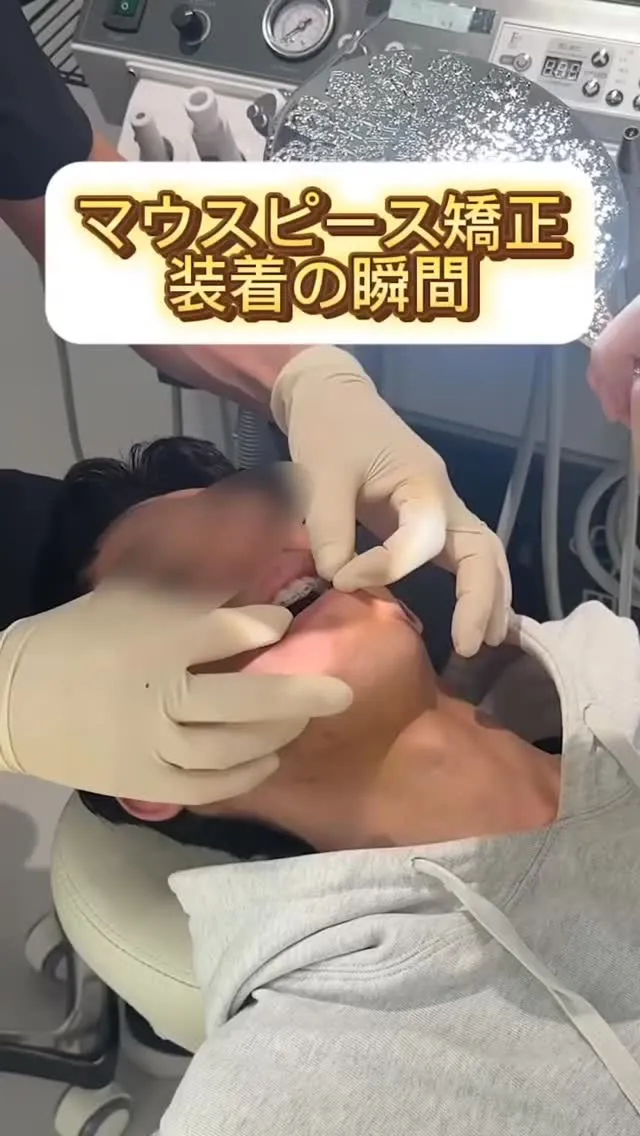 初めてのマウスピース矯正の様子です！#矯正歯科gosmile...