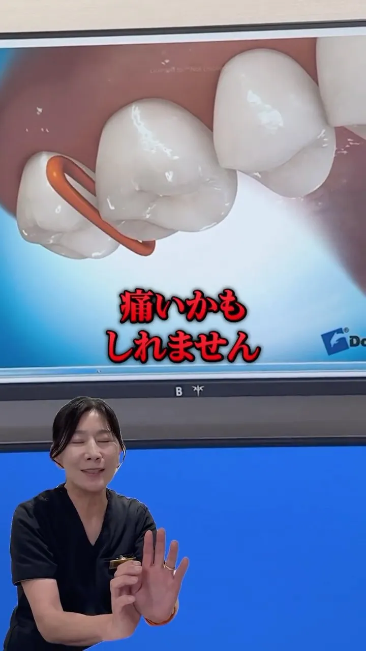 矯正で一番痛い治療かもしれません#矯正歯科gosmile横浜...