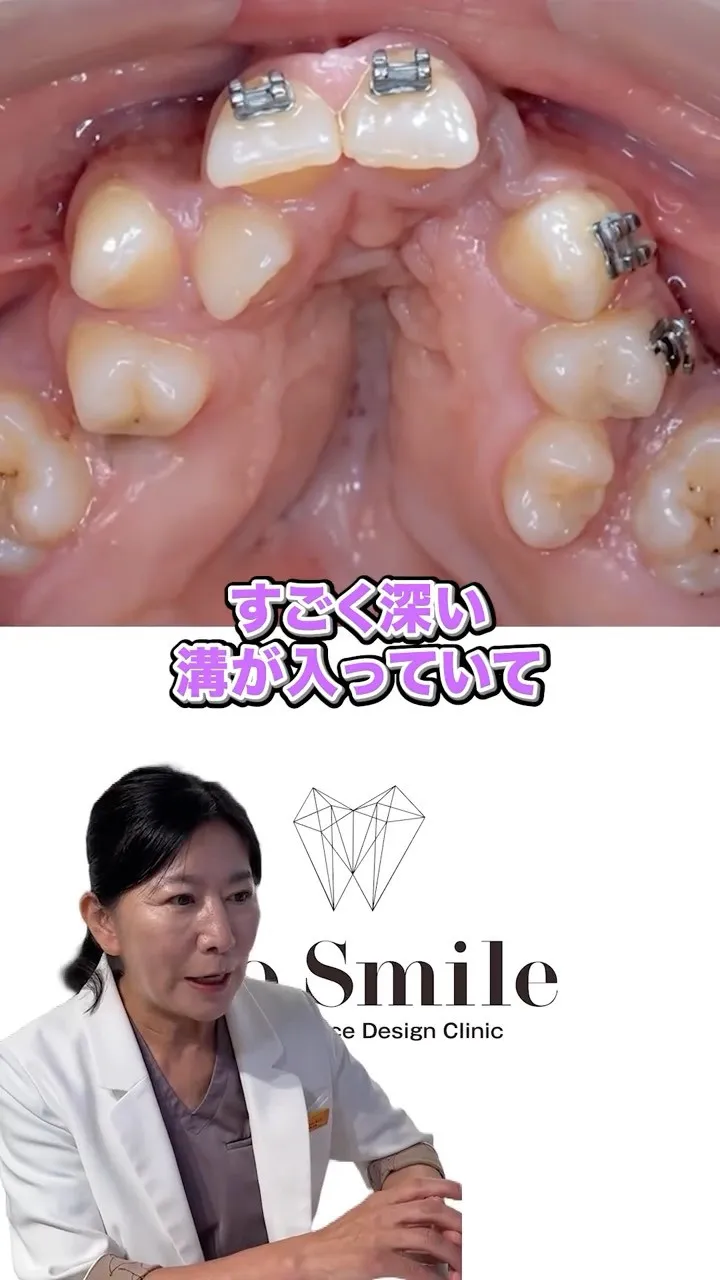 ここまで綺麗になるとハッピーですよね！