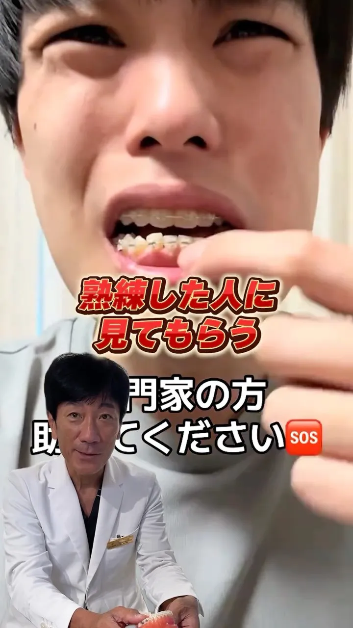 ワイヤー矯正する人はぜひ気をつけてください！#矯正歯科gos...